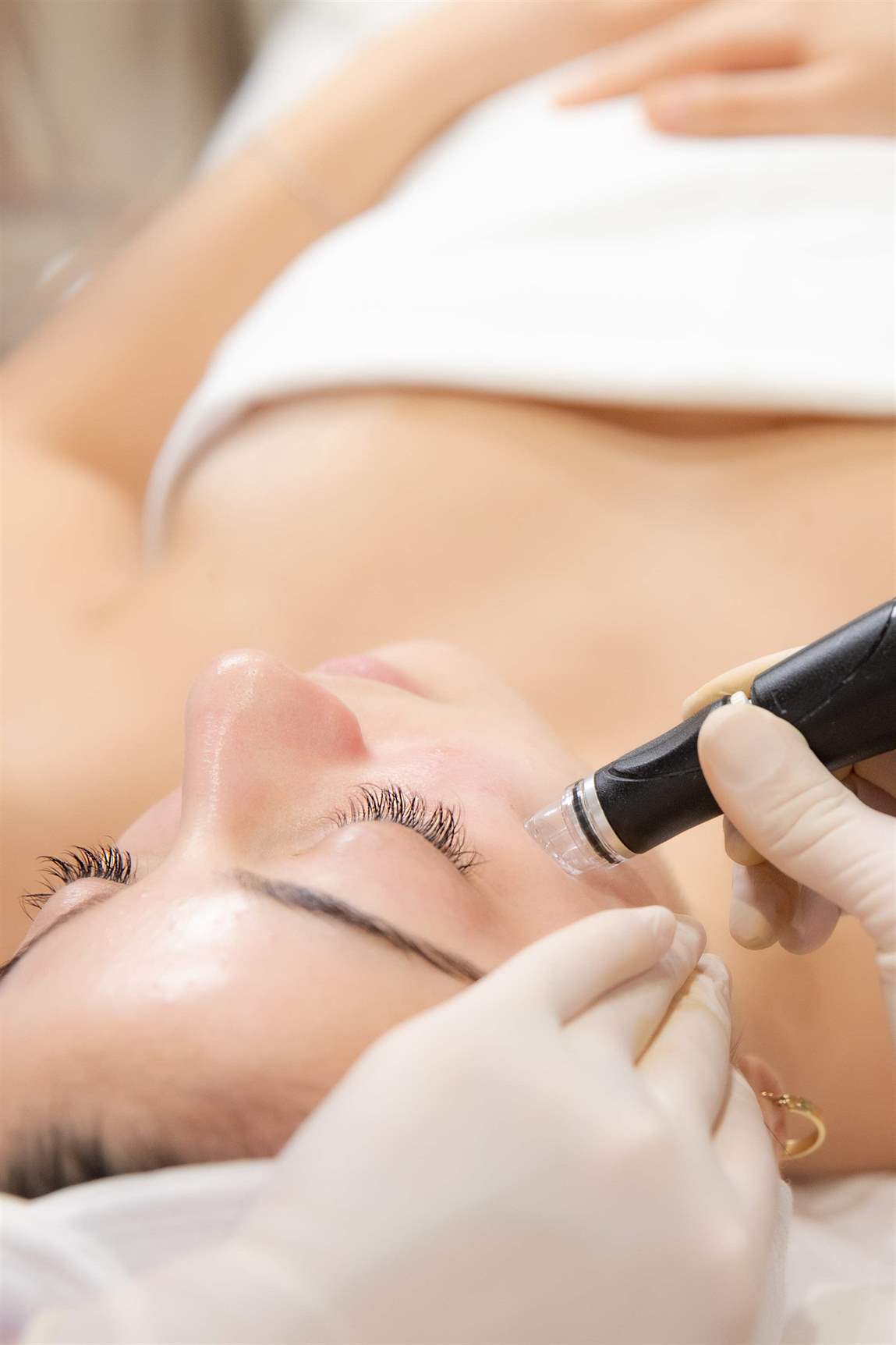 hydrafacial